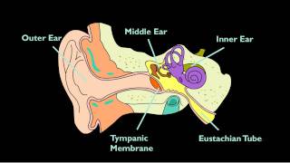 Otitis Media With Effusion [upl. by Kinchen]