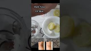 How to lighten dark skin on body  Treatment options for dark skin on body  skincare darkskin [upl. by Dagny]