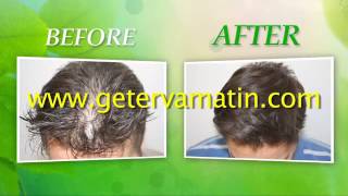 Ervamatin Hair Growth Lotion [upl. by Lock]