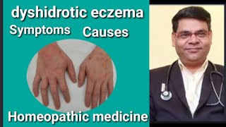 dyshidrotic eczema in hindi  dyshidrotic eczema treatment in hindi  dyshidrotic eczema kiya hai [upl. by Winnie]