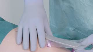 How to apply Mepilex Border PostOp Ag on the knee [upl. by Elaen838]