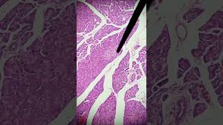 ¡Clave para identificar el PÁNCREAS ENDOCRINO en MICROSCOPIO histologíapancreas endocrino [upl. by Longerich737]