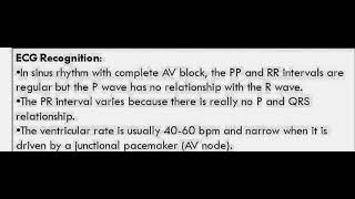 difference between high grade AV Block amp Complete heart block or AV dissociation on ECG [upl. by Irac]