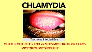 Chlamydia  Microbiology  Bacteriology Trachoma Quick revision for 2nd yr MBBS microbiology exams [upl. by Hallett505]