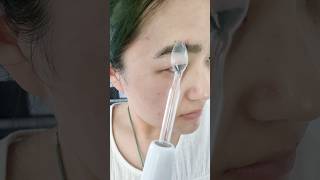 High frequency slaydarsonvalbeautyacnefacialbacktoschoolacnescarsskintreatmentacneremoval [upl. by Bunder]