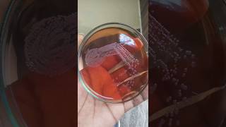 Bacterial colonies  culture media  bacterial growth on agar plates  how to grow bacteria biology [upl. by Aicnom]