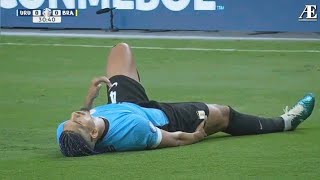 Araujo injury against Brazil in Copa America 2024 🤯 [upl. by Terb]