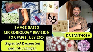 IMAGE BASED REVISION FMGE JULY 2024 MICROBIOLOGY  NEET PG 2024 [upl. by Tuneberg13]