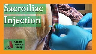 NEW SACROILIAC CORTISONE SHOT TECHNIQUE  Auburn Medical Group [upl. by Kincaid669]