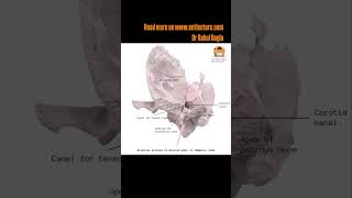 Anatomy of Temporal Bone  Link in Description  Dr Rahul Bagla Teaching ENT [upl. by Columbyne]