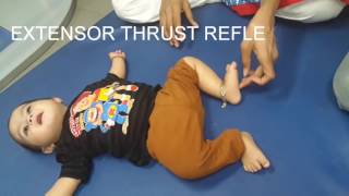 Down Syndrome  Physical Therapy for Down Syndrome PPT  Cerebral Palsy Reflexes  Presentation [upl. by Ahsiak]