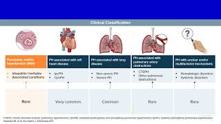 Connective tissue disease associated pulmonary hypertension Prof Mostafa Elshazly Chest Kasr ElAini [upl. by Lynna]