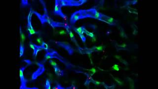 Example of laserinduced phototoxity in the liver [upl. by Ocir]