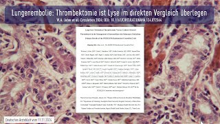 Lungenembolie Thrombektomie ist Lyse im direkten Vergleich überlegen [upl. by Sherburne617]