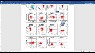 Microgranular APL [upl. by Jac]