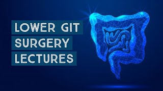 GIT SURGERY lecture 48 MECKELS DIVERTICULUM important points made easy [upl. by Ryley95]