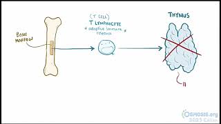 Digeorge Syndrome Osmosis [upl. by Durante846]