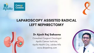 LAPAROSCOPIC LEFT RADICAL NEPHRECTOMY  KIDNEY CANCER  DR AJESH RAJ SAKSENA [upl. by Boarer917]