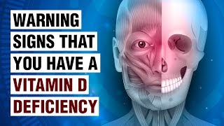 14 Signs Of Vitamin D Deficiency [upl. by Idid]