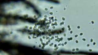 water mold zoospores [upl. by Hartzke]