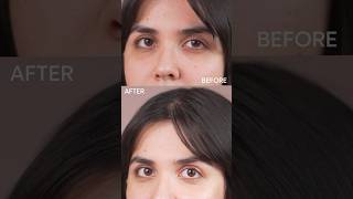 Effective Home Remedies for Dark Circles Under Eyes 👀 lorealparisindia  Heli Ved shorts ad [upl. by Correna]