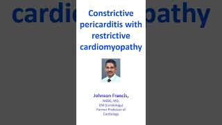 Constrictive pericarditis with restrictive cardiomyopathy [upl. by Hogue]