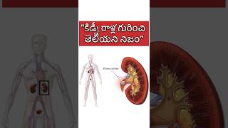 Unknown facts about kidney stones kidneystone telugufacts health [upl. by Valora]