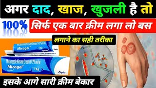 दाद खाज खुजली की बेस्ट क्रीम  micogel cream  micogel cream uses in hindi  miconazole nitrate [upl. by Renie]