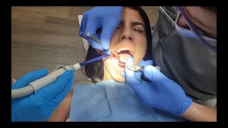 Dental Injection  Extraction  Dent Economy  Dentist  Dental [upl. by Baxie258]