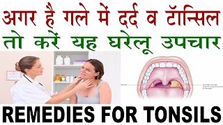 गले में दर्द व टॉन्सिल्स के लिये घरेलू उपाय  Remedies For Tonsils In Hindi  Tonsils Ka ilaj [upl. by Lielos]