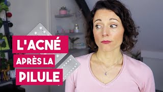 Comment gérer lacné hormonale après larrêt de la pilule [upl. by Yeslah764]