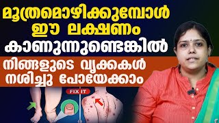 മൂത്രമൊഴിക്കുമ്പോൾ ഈ ലക്ഷണങ്ങൾ കണ്ടാൽ ശ്രദ്ധിക്കണം  KIDNEY FAILURE SYMPTOMS [upl. by Oran]