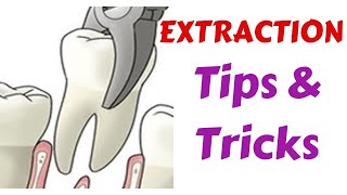 Exodontia Tips amp Tricks  Diagnosis amp Treatment Panning  Indication Medical amp Dental Evaluation [upl. by Atrice742]