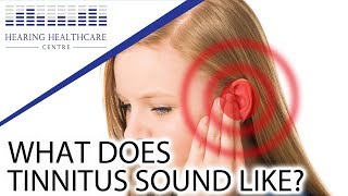 What Does Tinnitus Sound Like [upl. by Syck]