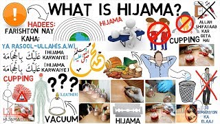 What is Hijama  Sunnah Way of Treatment  Maulana Tariq Jameel Animated [upl. by Annaik]