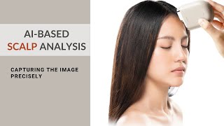 How to capture the image  Scalp analysis [upl. by Alverta932]