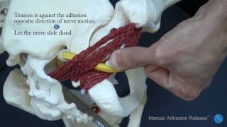 Integrative Diagnosis Sciatic nerve adhesion diagnosis and treatment with Manual Adhesion Release® [upl. by Riem]