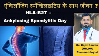 एंकिलॉज़िंग स्पॉन्डिलाइटिस के साथ कैसे जिये  । Life with Ankylosing Spondylitis [upl. by Erdna192]