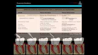 Planejamento do Diagnóstico e Tratamento Endodôntico [upl. by Robbert]