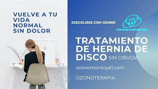 Hernia de disco sin cirugía mediante ozonoterapia [upl. by Thrift840]