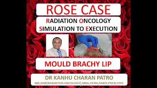 STEPS IN MOULD BRACHYTHERAPY OF CANCER LIP [upl. by Georg]