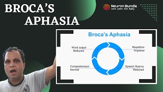 broca’s aphasia  expressive aphasia clinical features learn with examples aphasia [upl. by Milla430]