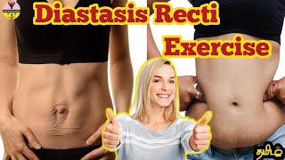 Diastasis recti exercise in tamil தமிழ் weightloss diastasisrecti pregnancyexercise [upl. by Airdnekal]