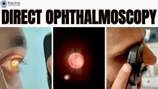 Direct Ophthalmoscopy [upl. by Chancellor16]