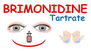 Brimonidine tartrate eye drops [upl. by Ortiz]