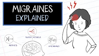 What are Migraines HealthSketch [upl. by Ashby]