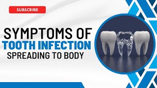 Tooth Infection Spreads Recognizing the Symptoms and What to Do [upl. by Marguerite]