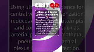 UltrasoundGuided Cannulation Benefits [upl. by Alston]