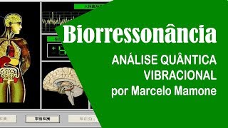 Biorressonância Análise Quântica Vibracional [upl. by Asile176]