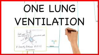 ONE LUNG VENTILATION PHYSIOLOGY SERIES [upl. by Cruickshank]